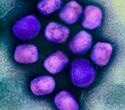 Research highlights rising risk of human-to-human mpox transmission