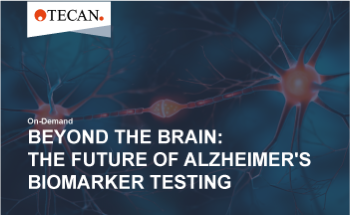 Redefining Alzheimer’s diagnostics with blood-based biomarkers